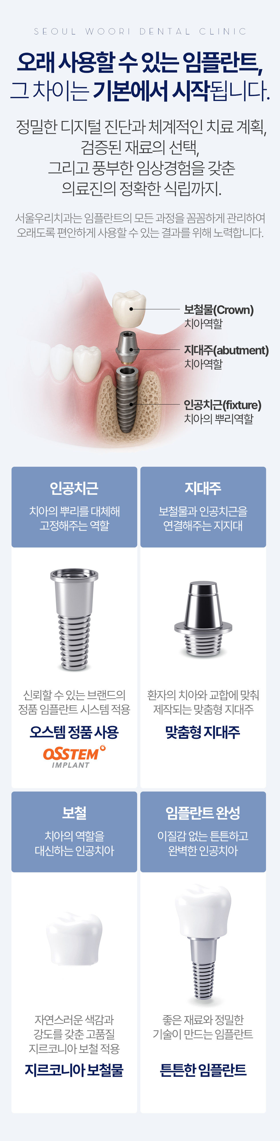 오래 사용할 수 있는 임플란트, 정밀 디지털 진단과 맞춤형 지대주·지르코니아 보철