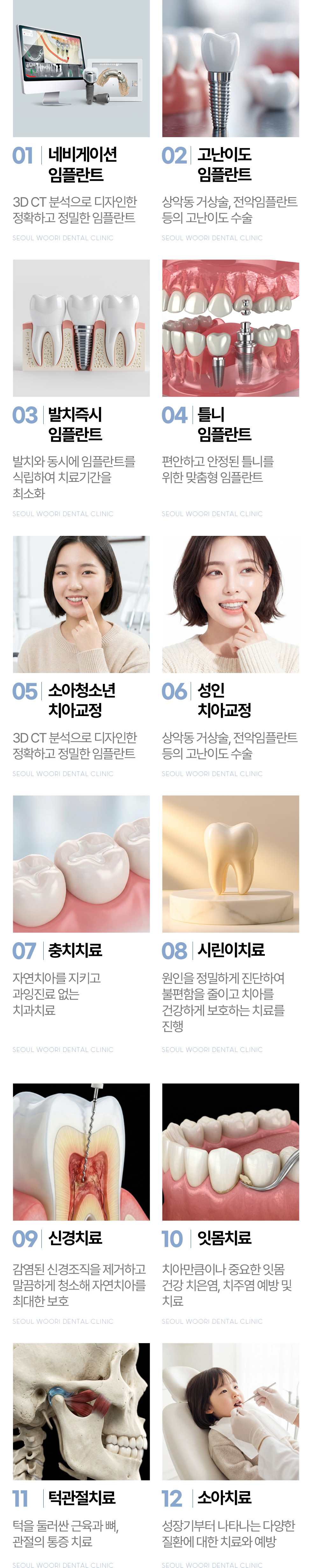 서울우리치과 진료과목, 네비게이션 임플란트부터 소아치료까지 12개 진료 서울우리치과 진료과목, 네비게이션 임플란트부터 소아치료까지 12개 진료