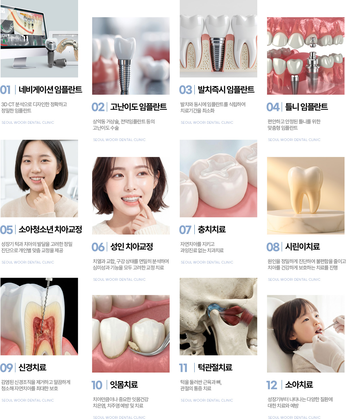 서울우리치과 진료과목, 네비게이션 임플란트부터 소아치료까지 12개 진료 서울우리치과 진료과목, 네비게이션 임플란트부터 소아치료까지 12개 진료